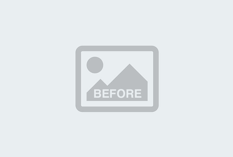Before Image: Breast Lift - front