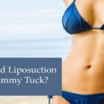 Dr. Restifo Tummy Tuck