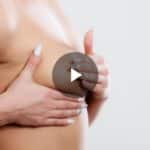 Dr. Restifo Breast Lift & Augmentation