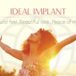 ideal implant
