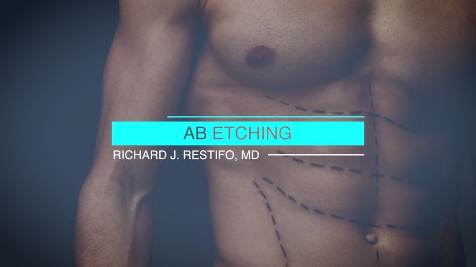 Ab Etching