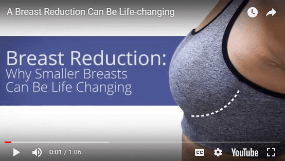 Breast Reduction Video Graphic