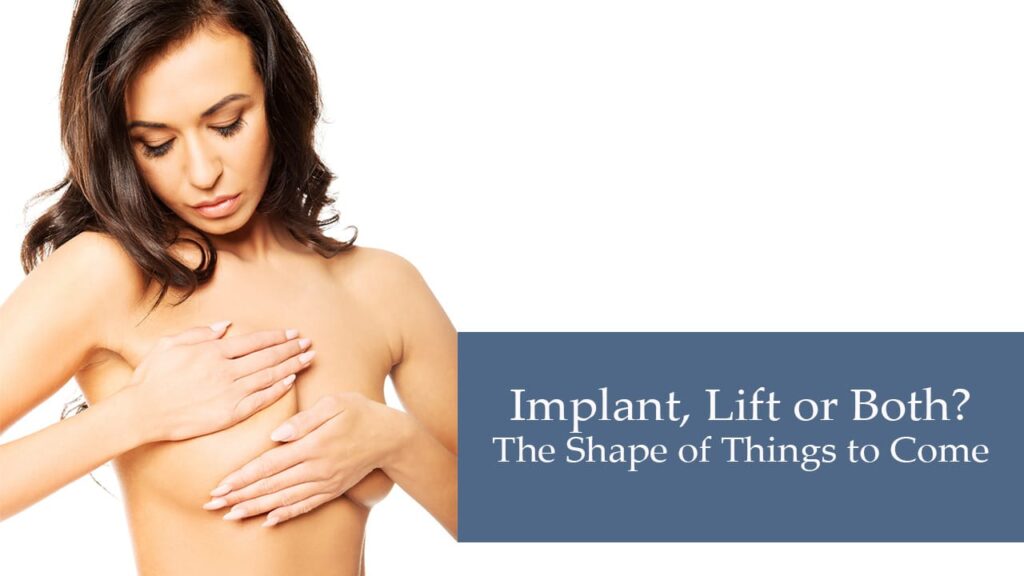 Do I Need an Implant Lift or Both