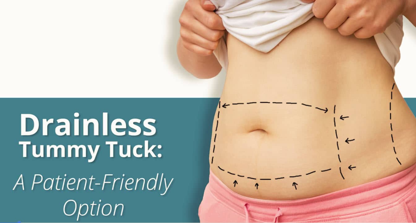 Drainless Tummy Tuck Still