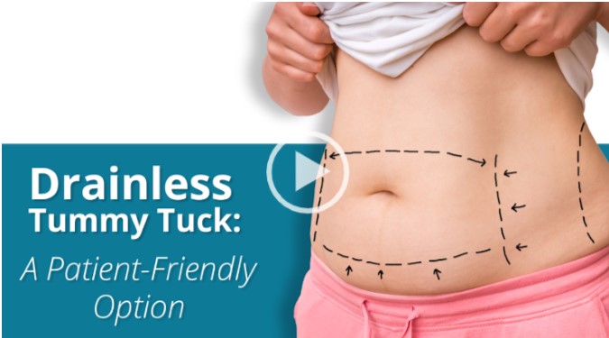 TissuGlu Drainless Tummy Tuck