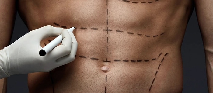Abdominal Etching: An Easier Way To Get A Six-Pack 1 abdominal etching